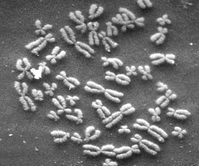 Chromosomes as captured via electron micrograph