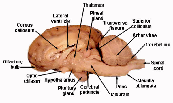 Sheep brain Sagittal view