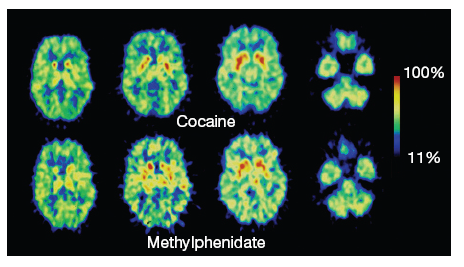 Ritalin and Cocaine 