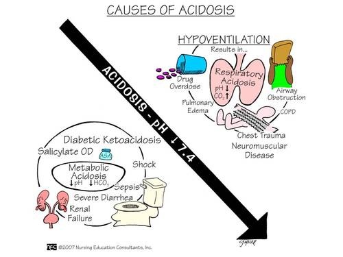 Acidosis