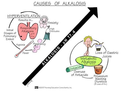 Alkalosis