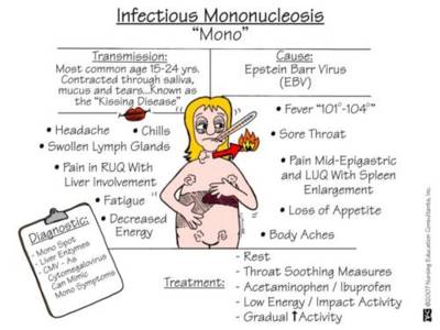 Infectious Mononucleosis