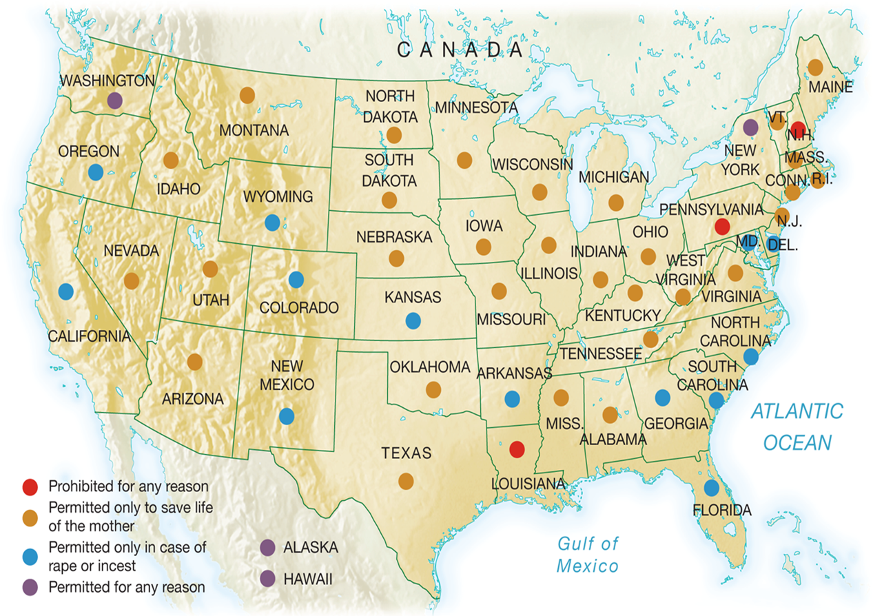 State Laws on Abortion prior to  Roe v. Wade, 1973