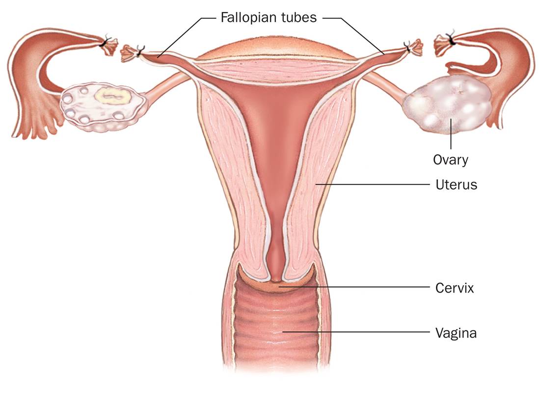 Tubal Sterilization 