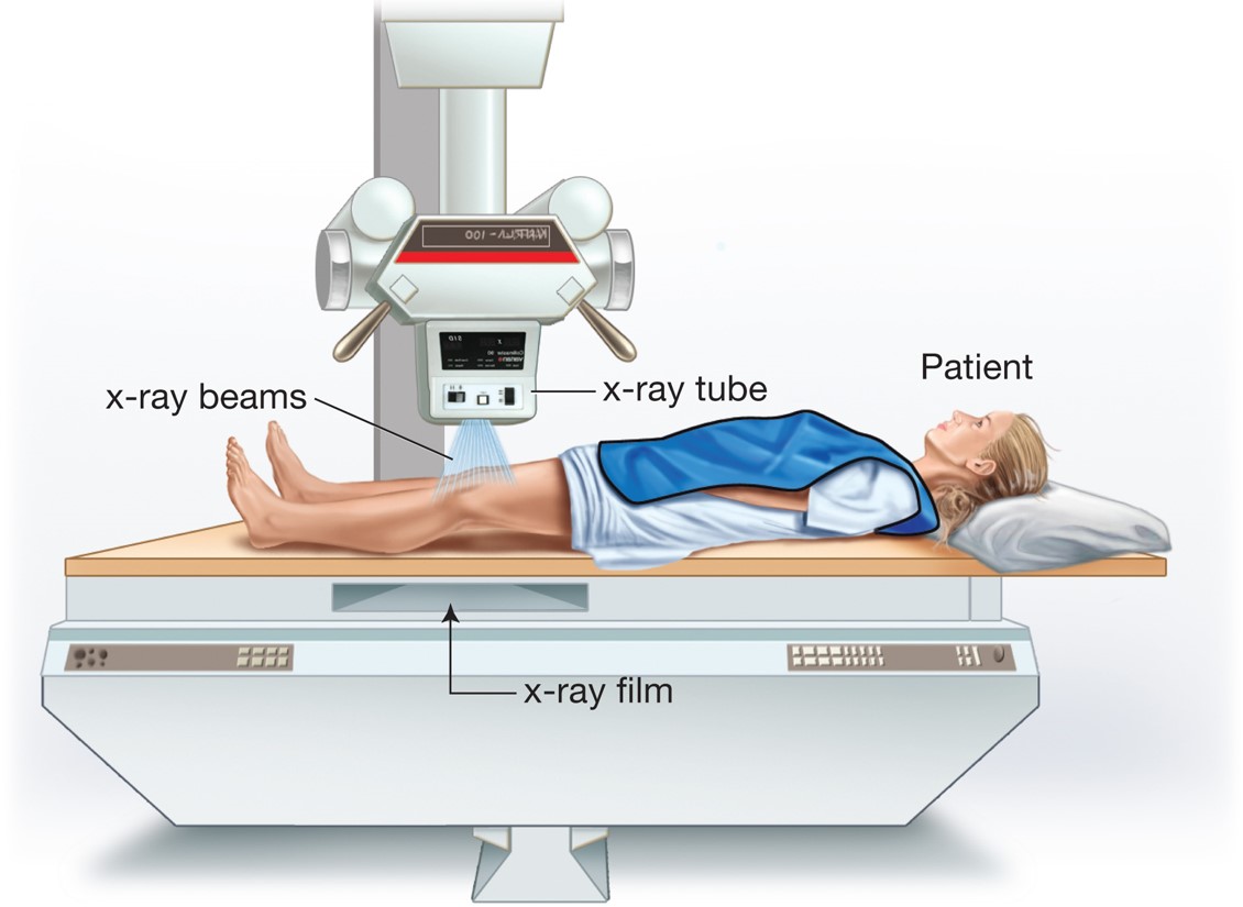 The patient is placed between the X-ray tube, which emits a cone-shaped X-ray beam, and the film or ...