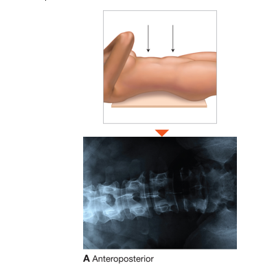 Examples of the most common X-ray positions and the images they produce. 