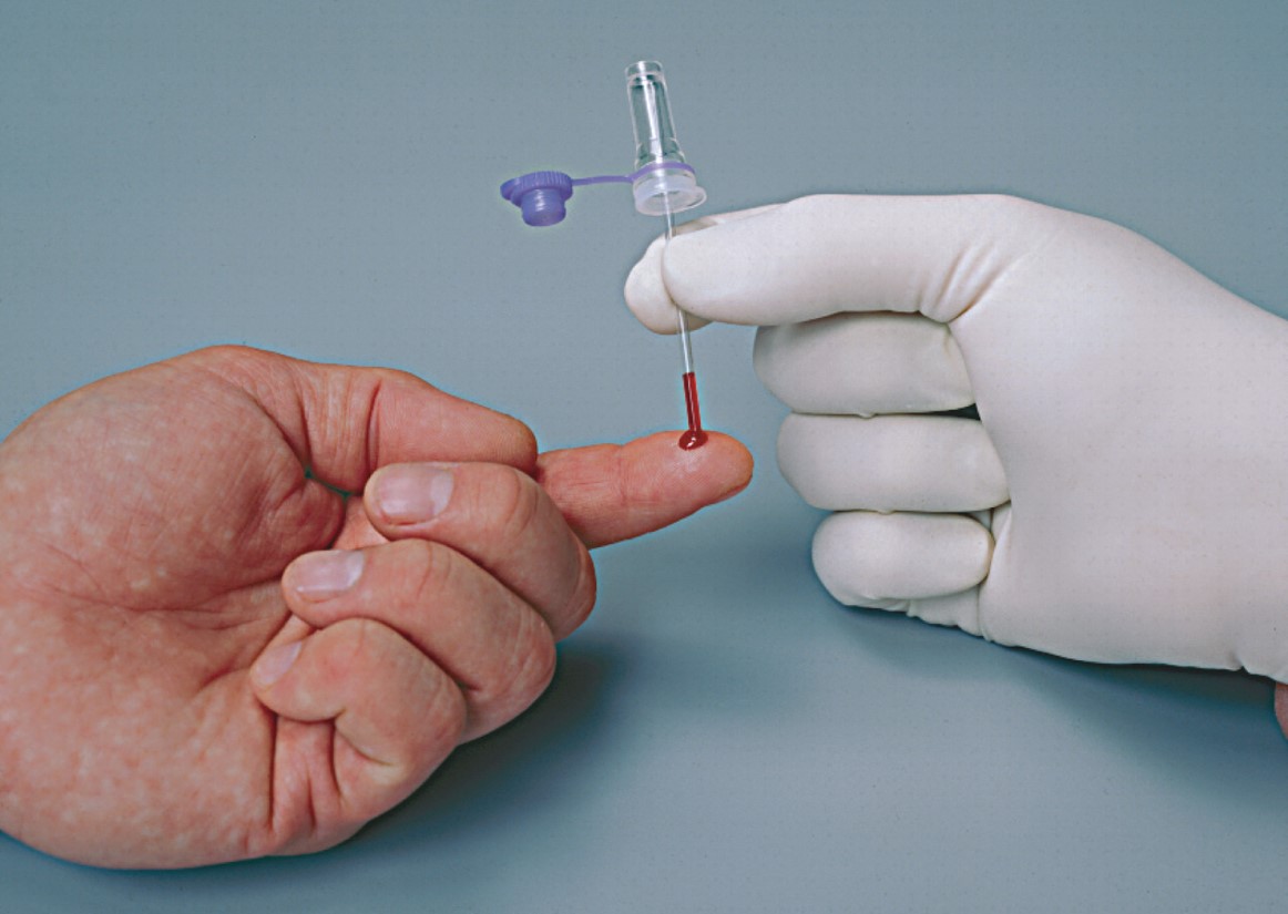 A finger-stick is useful for obtaining small amounts of blood.