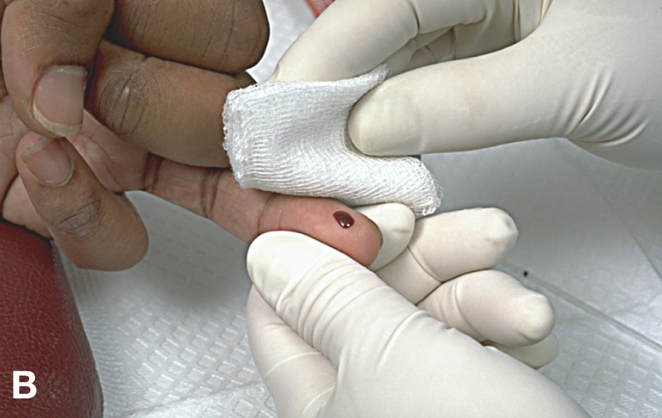 Performing a Capillary Puncture (Manual) 