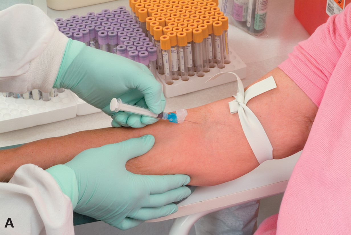 Demonstrating the use of venipuncture equipment. Using a syringe to draw blood.