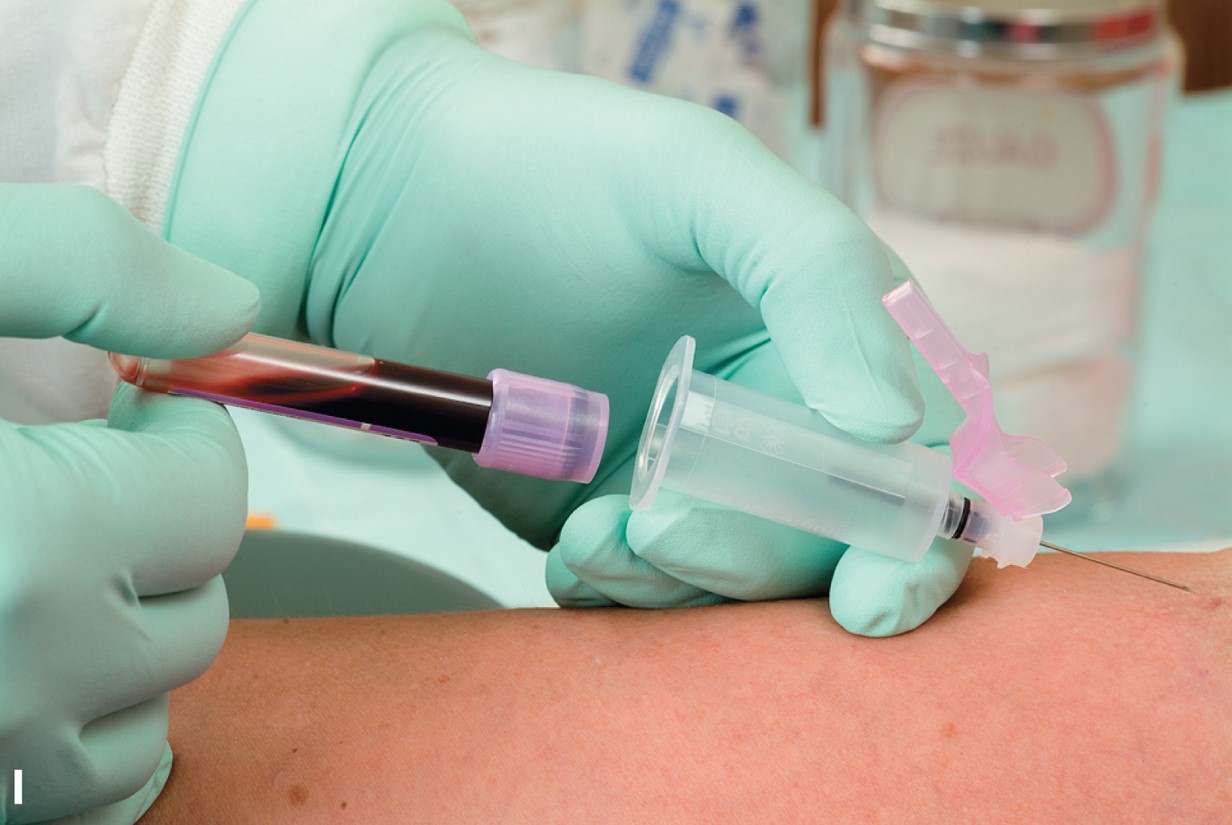 Performing Venipuncture Using the Vacutainer Method