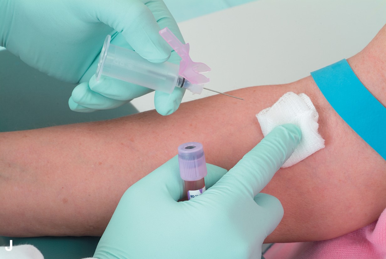 Performing Venipuncture Using the Vacutainer Method