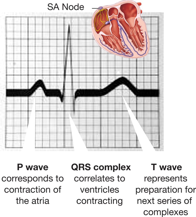 The cardiac cycle and an ECG tracing.