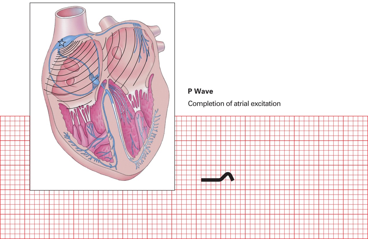 P wave (SA node initiates atrial depolarization).