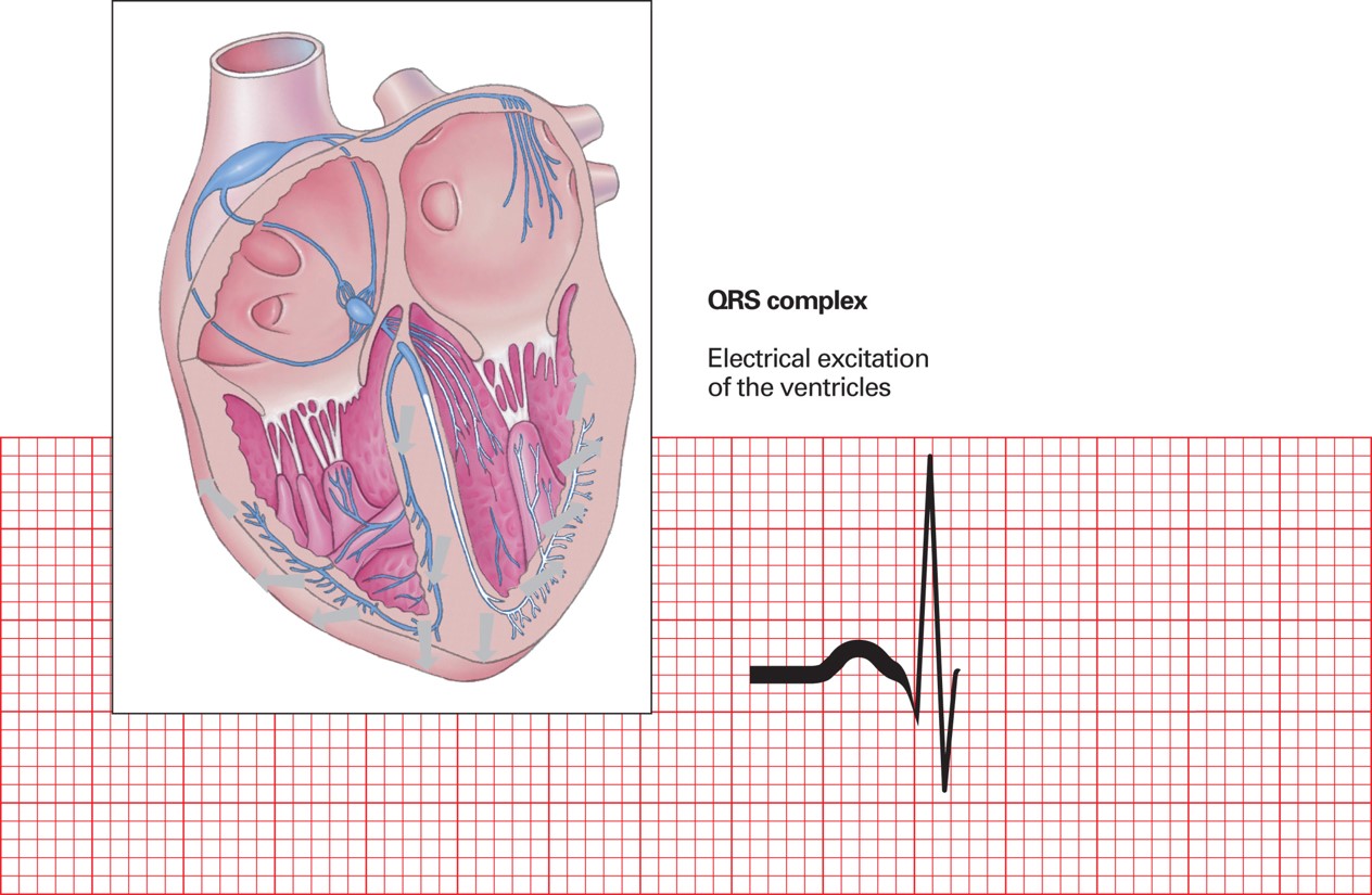 QRS complex (ventricular depolarization).