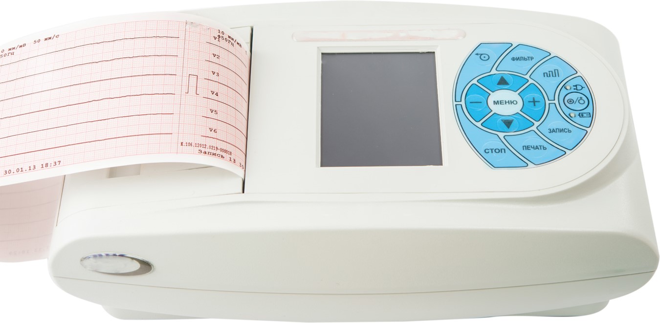 A multichannel ECG. 