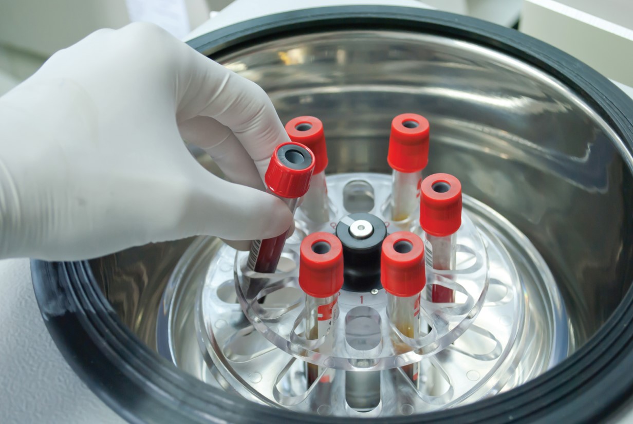 Performing a Microhematocrit