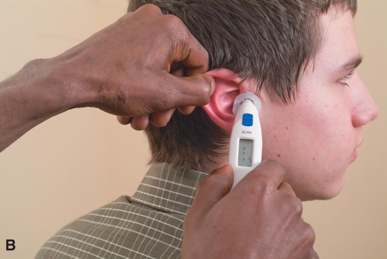 Measuring Temperature Using a Tympanic Membrane (Aural) Thermometer