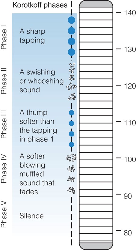 Phases of the Korotkoff sounds.