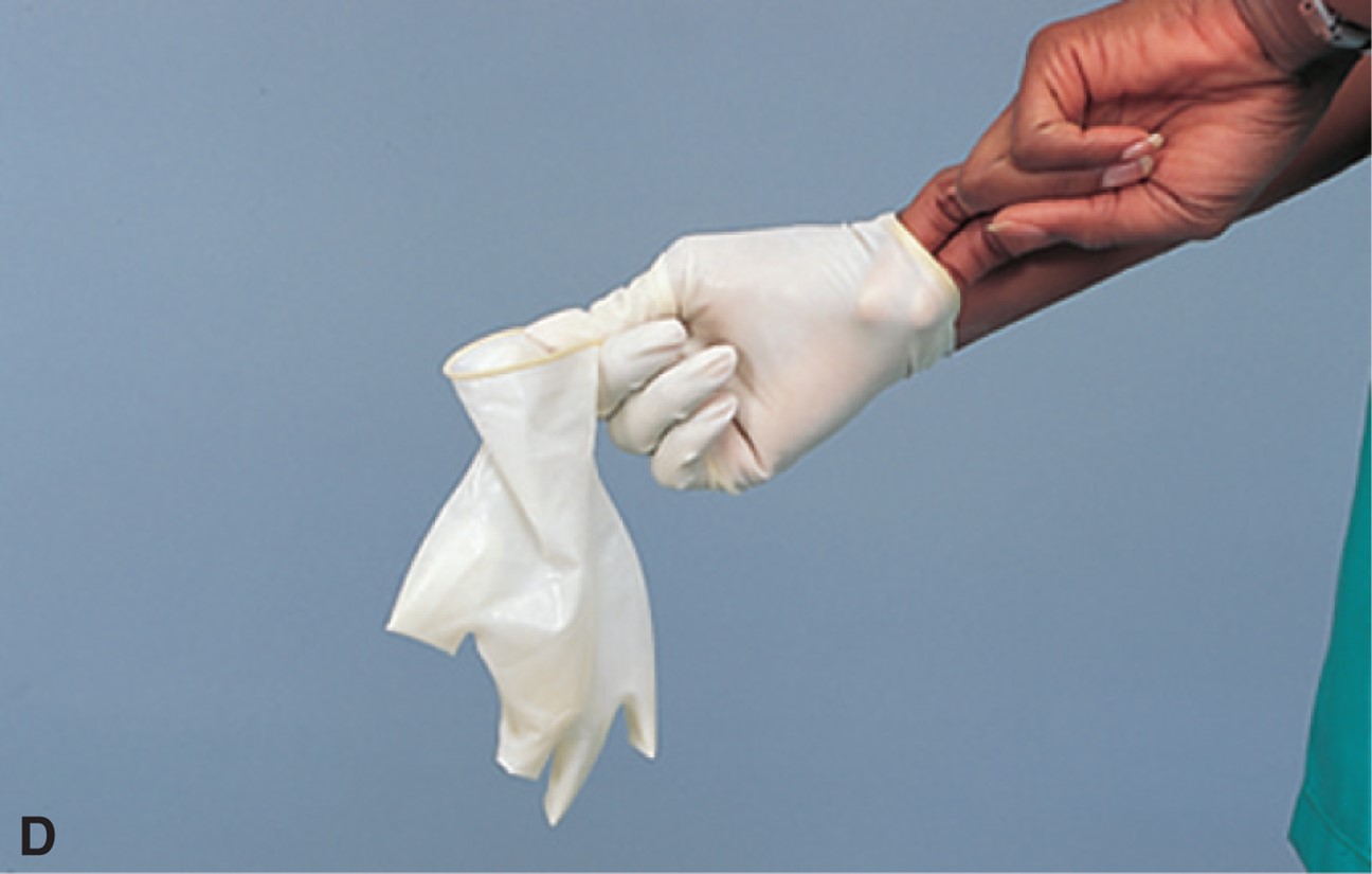 Applying and Removing Nonsterile Gloves