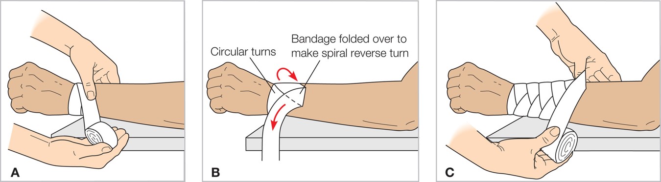 Applying a Bandage over a Sterile Dressing