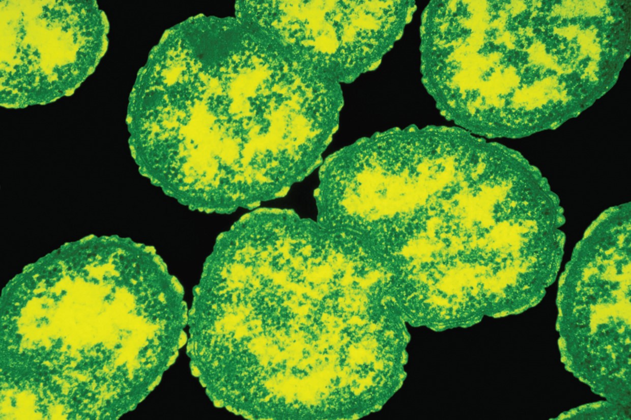 Gram negative N. gonorrhoeae. 