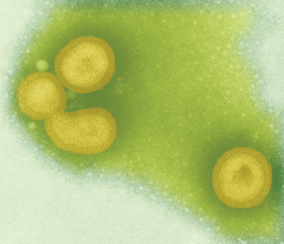 Influenza virus. 