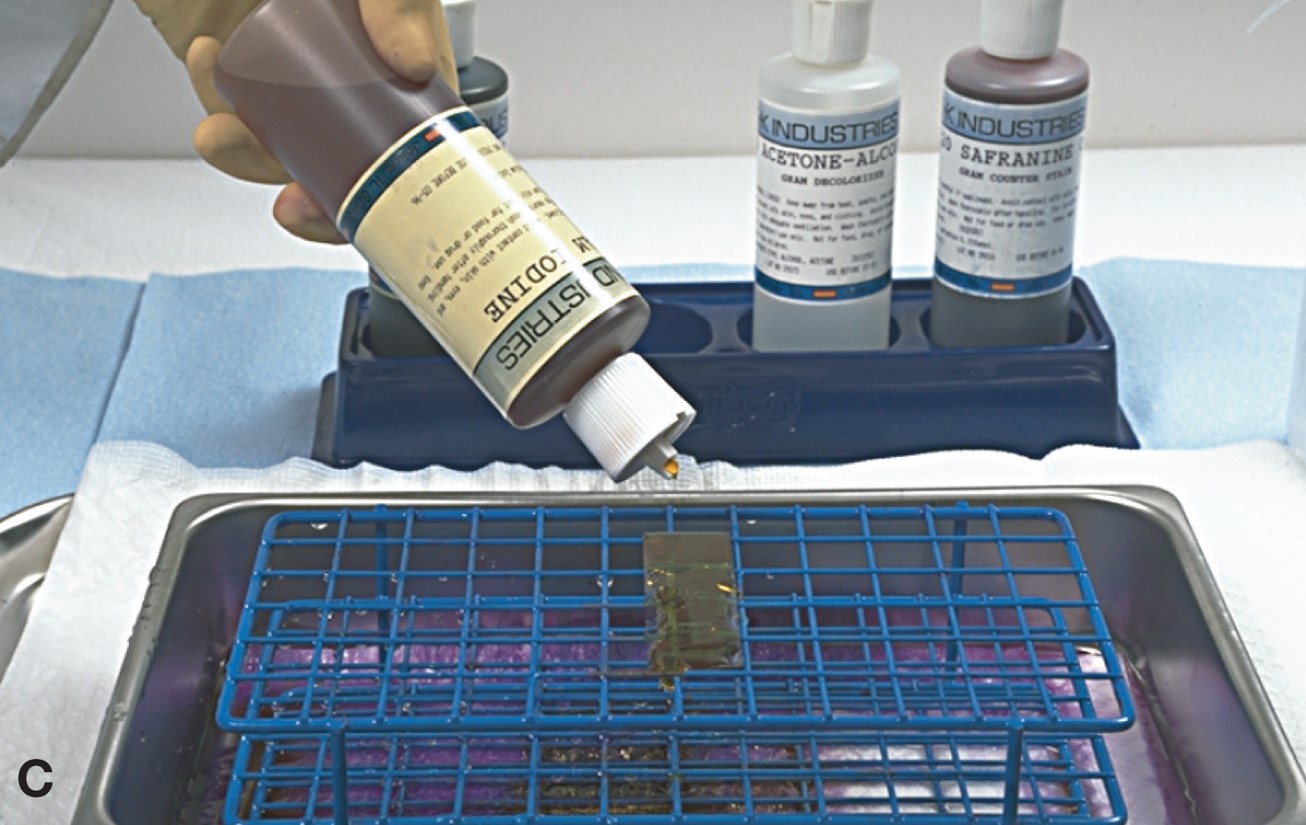 Performing a Gram Stain