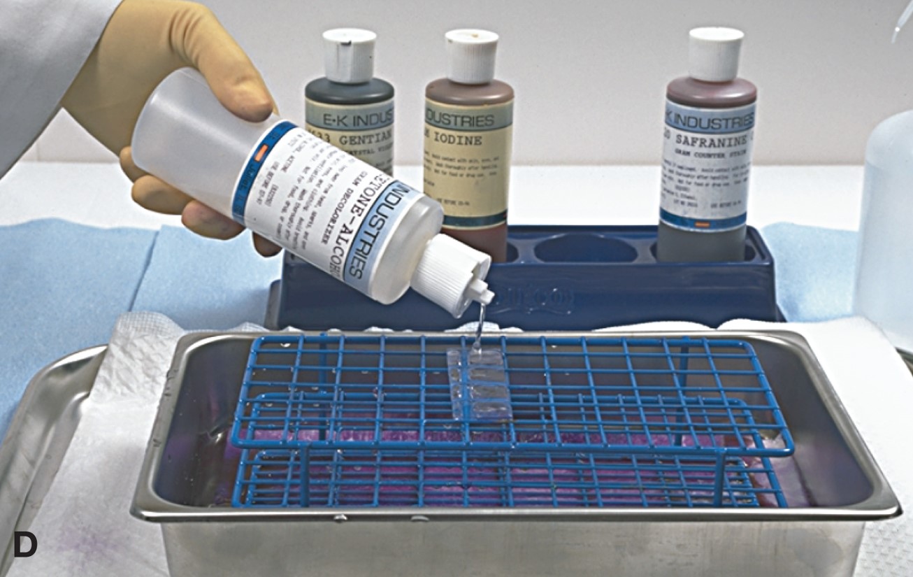 Performing a Gram Stain