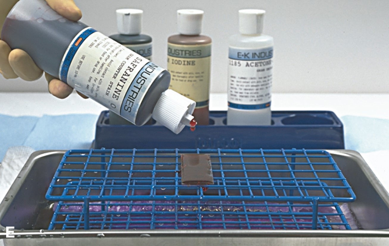 Performing a Gram Stain