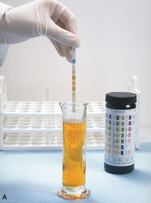 Testing the Chemical Characteristics of Urine with Reagent Strips