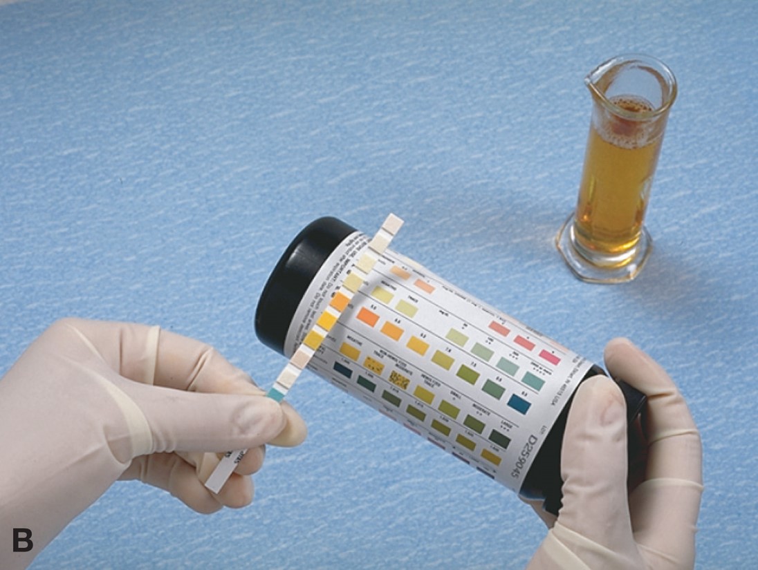 Testing the Chemical Characteristics of Urine with Reagent Strips