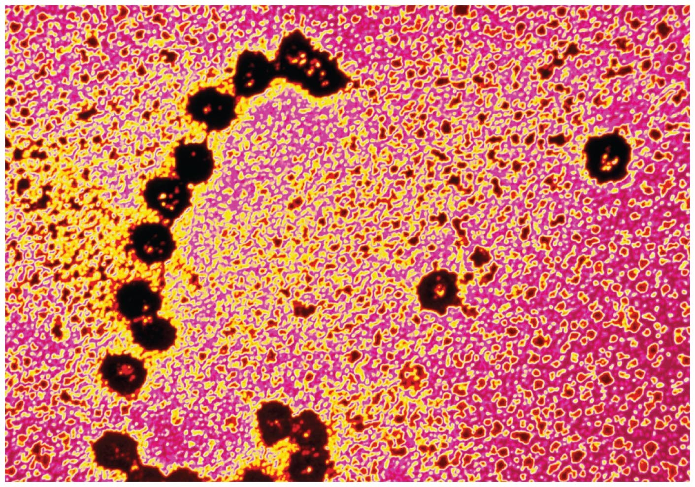 Colorized election micrograph of a polyribosome.