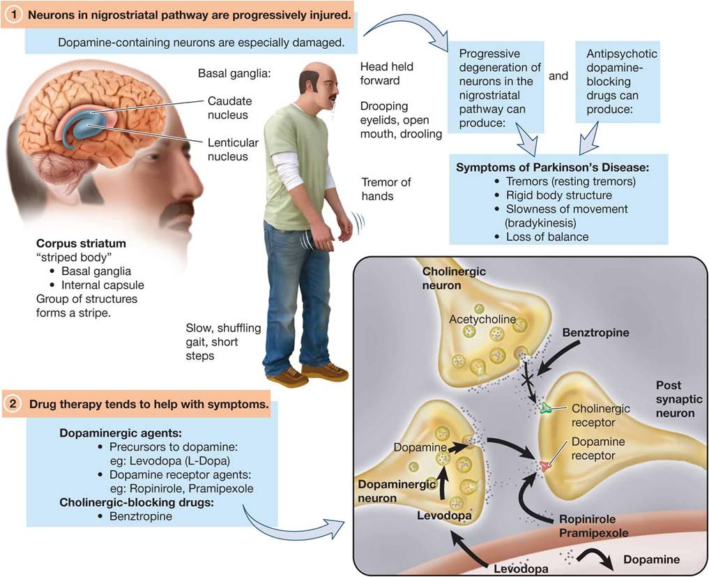 Antiparkinson Drugs Focus on Restoring Dopamine Function and Blocking Cholinergic Activity in the Ni