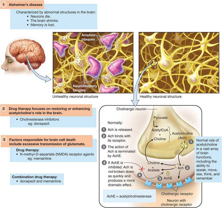 Alzheimer’s Drugs Work by Intensifying the Effect of Acetylcholine at the Receptor