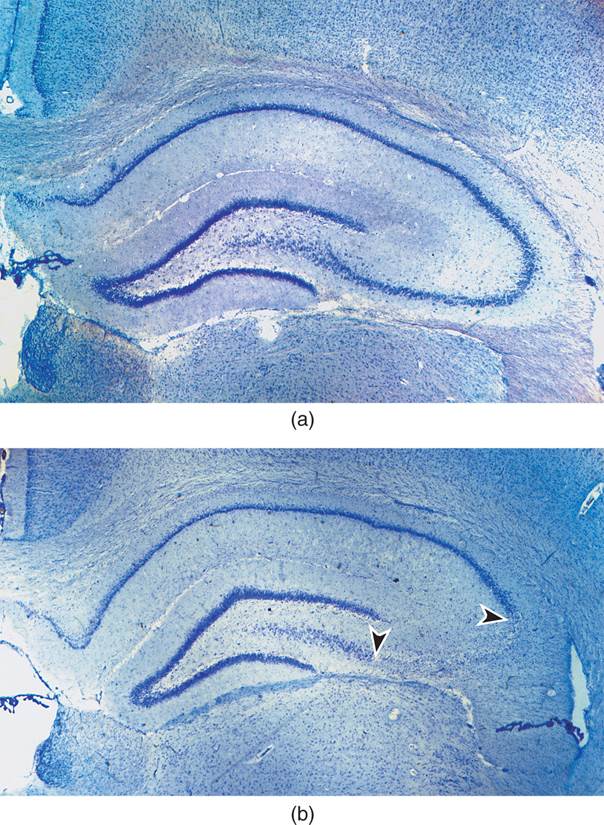 Excitotoxic Lesion 