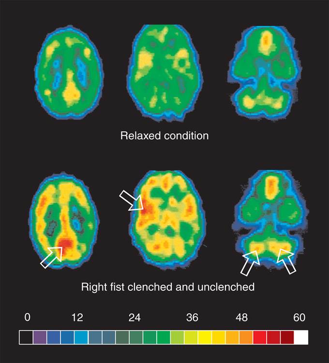 PET Scans 