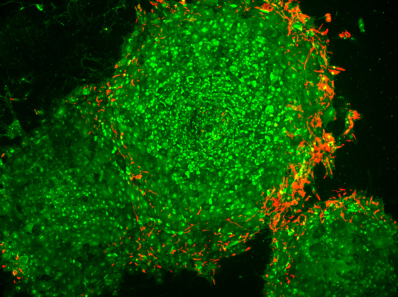 Human embryonic stem cells stained with Tra-1-60 (green) - a stem cell marker and nestin (red), a ne