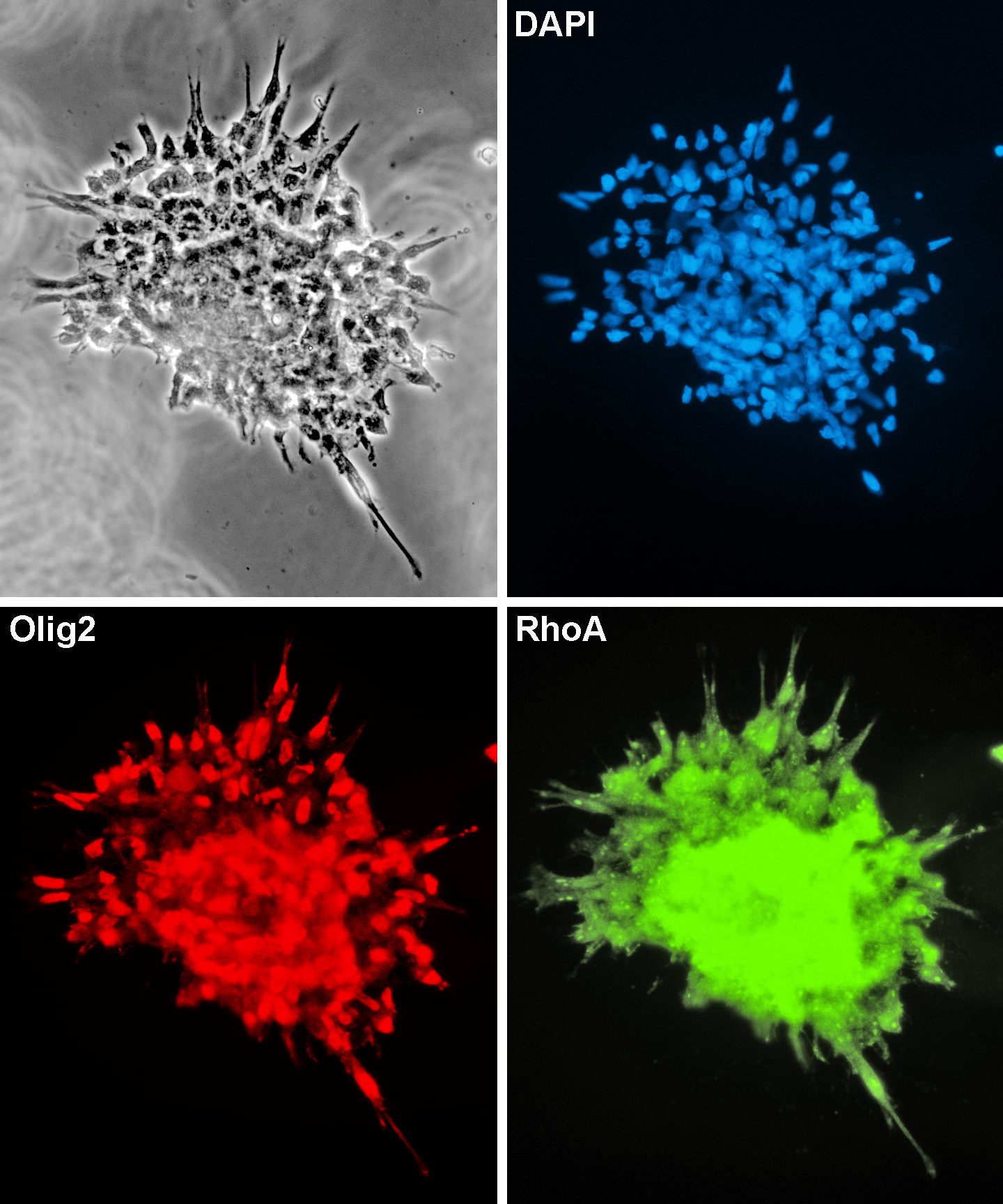 Human neural stem cells derived from hESCs, engineered to over-express Olig2