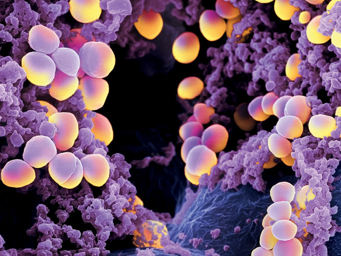 STAPHYLOCOCCUS AUREUS