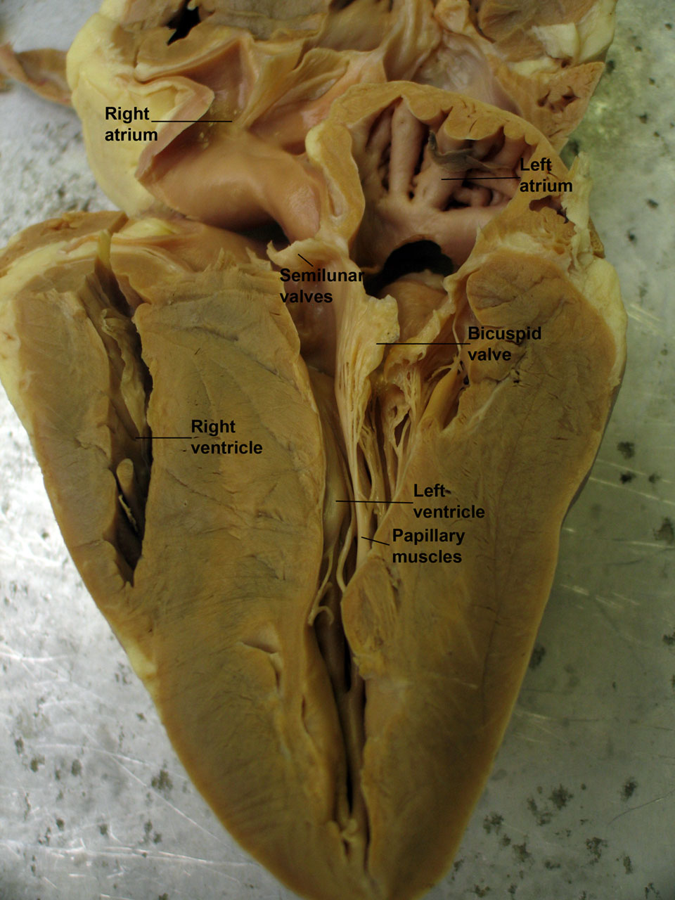 SHEEP HEART