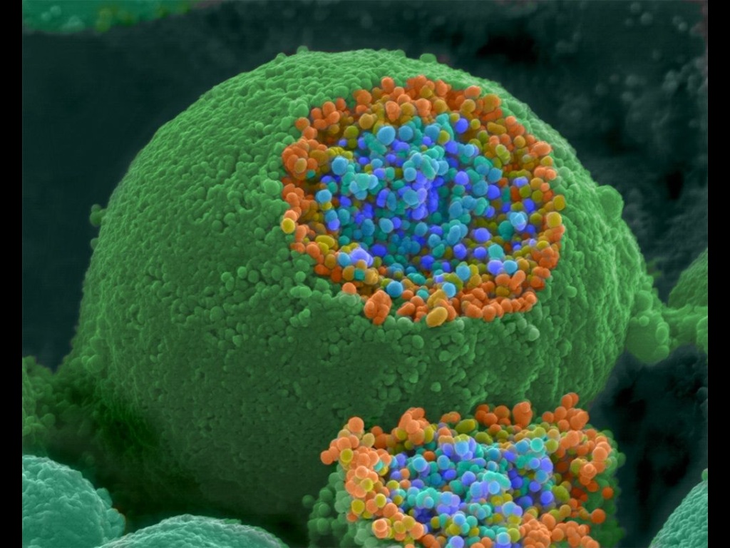 Nerve ending scanned by electron micrograph