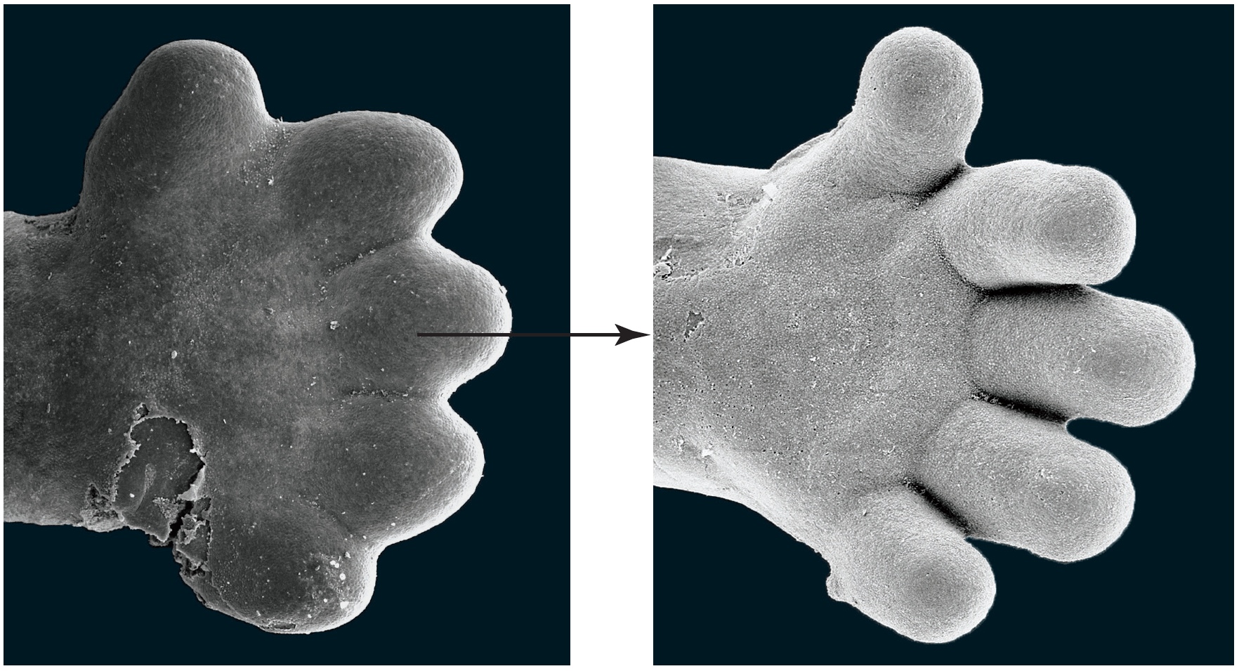 Apoptosis in the formation of a human hand