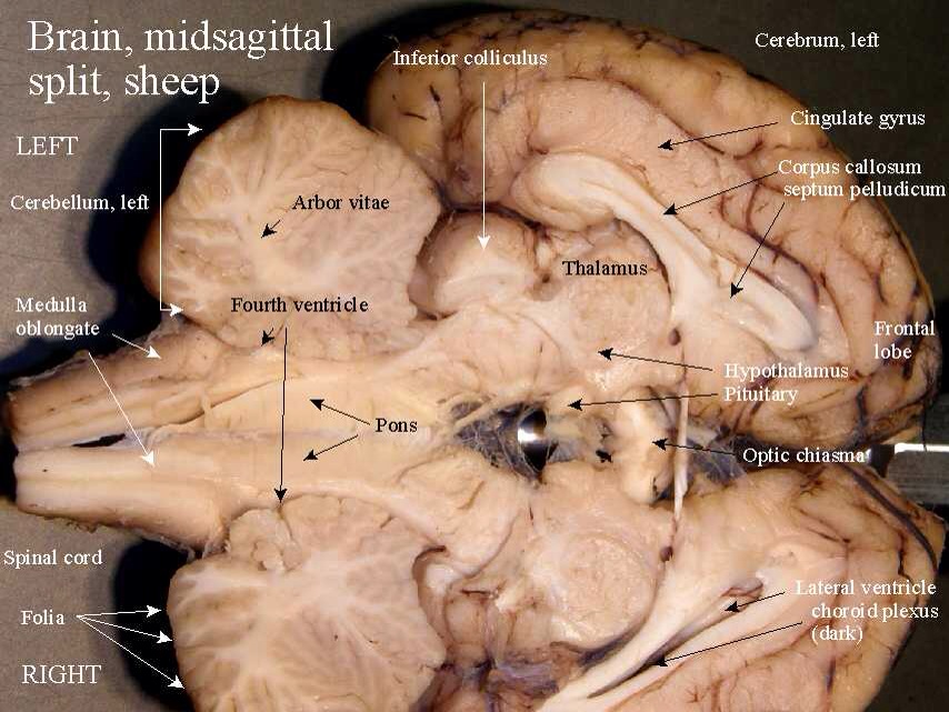 Sheep Brain Dissection