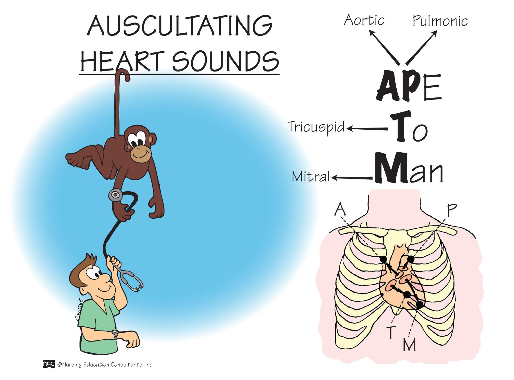 Heart Sounds