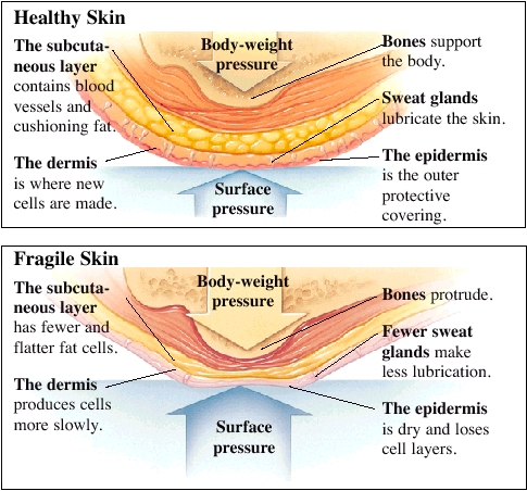 human skin and pressure points