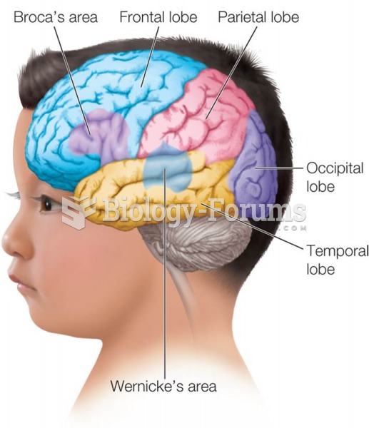 Illustration of the Brain  Lobes Showing Location of Broca’s Area and Wernicke’s Area