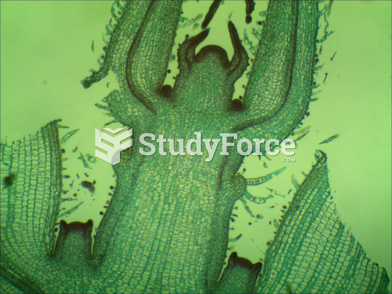 Microscopic View of Coleous Shoot