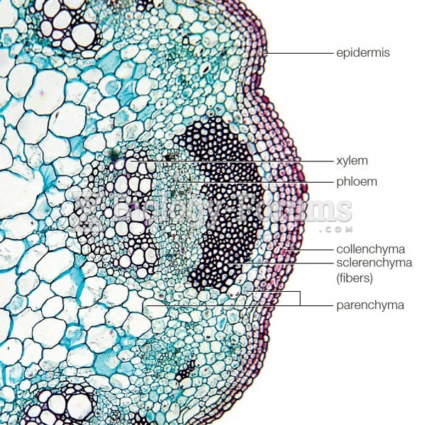 Locations of tissues in the stem of  a sunflower (Helianthus).