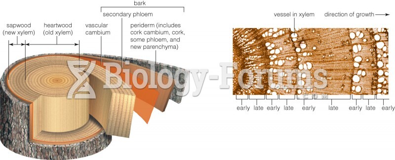 Structure of a woody stem (comparison)