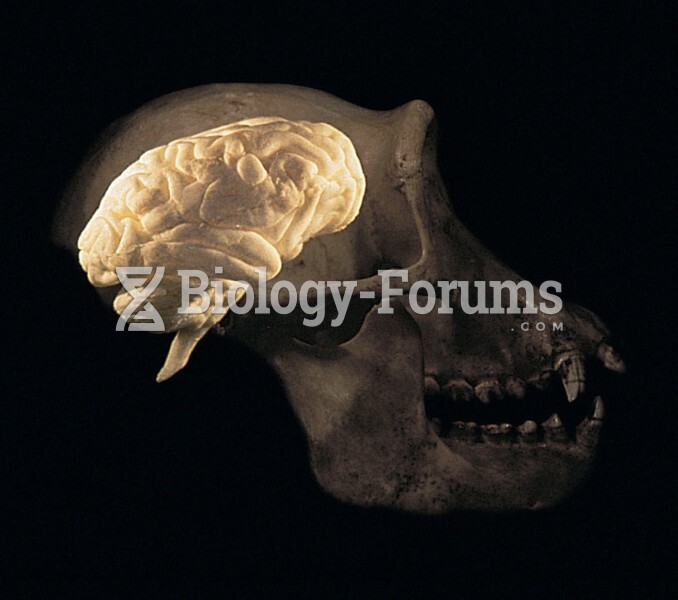 Chimpanzee brain